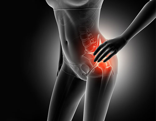 Hemireplacement / Partial Replacement Of Hip Joint